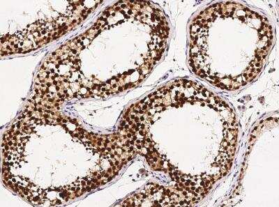 Immunohistochemistry-Paraffin: ASF1b Antibody (002) [NBP2-90278]