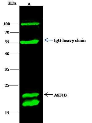 Immunoprecipitation: ASF1b Antibody (004) [NBP2-90279]