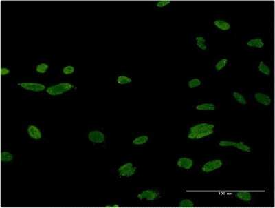 Immunocytochemistry/ Immunofluorescence: ASF1b Antibody (1B12) [H00055723-M03]