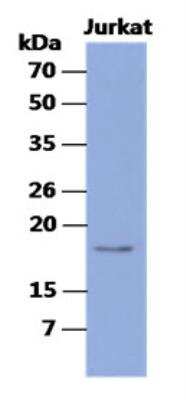 Western Blot: ASF1b Antibody (1D4)BSA Free [NBP2-42676]