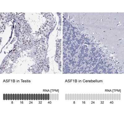 Immunocytochemistry/ Immunofluorescence: ASF1b Antibody [NBP3-16994]