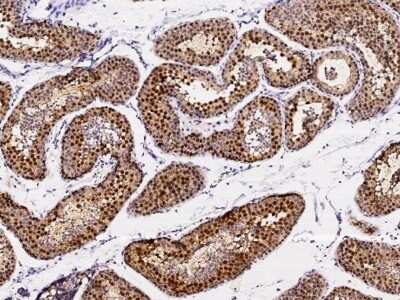 Immunohistochemistry-Paraffin: ASF1b Antibody [NBP3-00286]