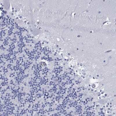 Immunohistochemistry-Paraffin: ASF1b Antibody [NBP3-16994]