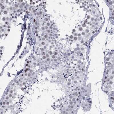 Immunohistochemistry-Paraffin: ASF1b Antibody [NBP3-16994]