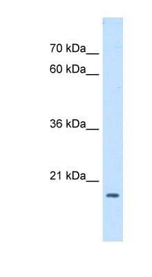 Western Blot: ASF1b Antibody [NBP1-52947]