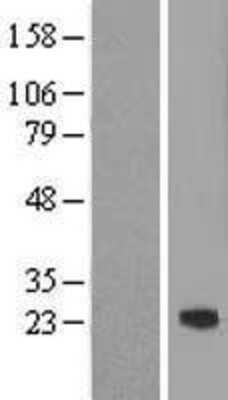 Western Blot: ASF1b Overexpression Lysate [NBL1-07761]