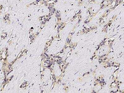 Immunohistochemistry-Paraffin: ASGPR1 Antibody (011) [NBP2-89635]