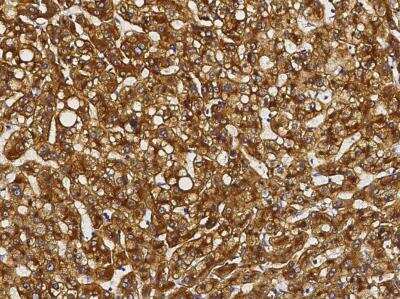 Immunohistochemistry-Paraffin: ASGPR1 Antibody (011) [NBP2-89635]