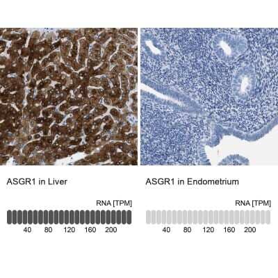 Immunohistochemistry-Paraffin: ASGPR1 Antibody [NBP1-85580]