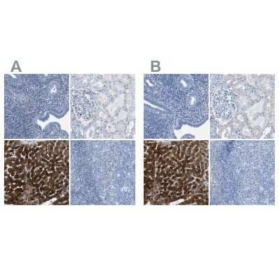Immunohistochemistry-Paraffin: ASGPR1 Antibody [NBP1-85581]