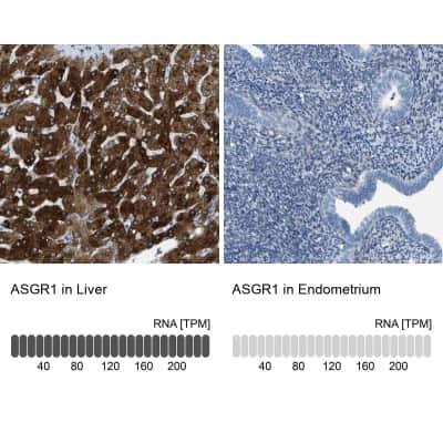 Immunohistochemistry-Paraffin: ASGPR1 Antibody [NBP1-85581]