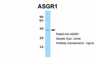 Western Blot: ASGPR1 Antibody [NBP1-54385]