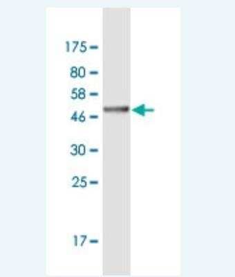 Western Blot: ASH1 Antibody (4G12) [H00055870-M01-100ug]