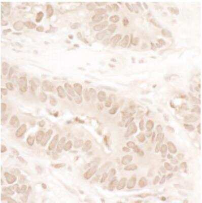 Immunohistochemistry-Paraffin: ASH1 Antibody [NB100-93290]