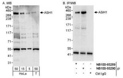 Western Blot: ASH1 Antibody [NB100-93290]