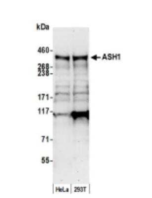 Western Blot: ASH1 Antibody [NB100-93290]