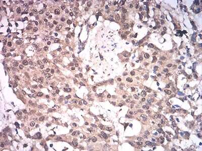 Immunohistochemistry: ASH2L Antibody (6B10H10) - BSA Free [NBP2-61686]