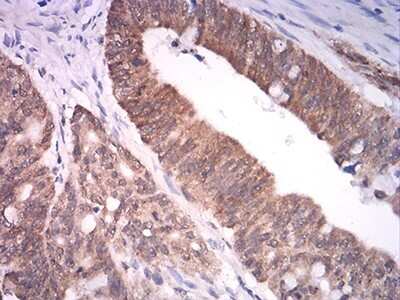 Immunohistochemistry: ASH2L Antibody (6B10H10) - BSA Free [NBP2-61686]