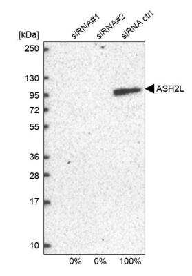 Western Blot: ASH2L Antibody [NBP1-88858]