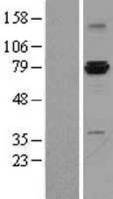 Western Blot: ASH2L Overexpression Lysate [NBL1-07765]