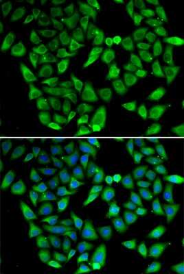 Immunocytochemistry/ Immunofluorescence: ASIP Antibody - BSA Free [NBP3-04873]