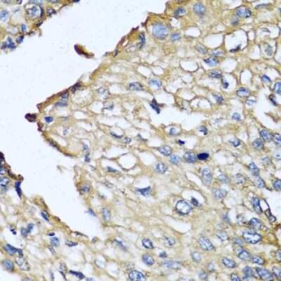 Immunohistochemistry-Paraffin: ASIP Antibody - BSA Free [NBP3-04874]