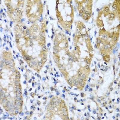 Immunohistochemistry-Paraffin: ASIP Antibody - BSA Free [NBP3-04874]