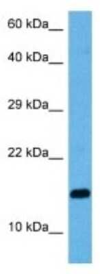 Western Blot: ASIP Antibody [NBP3-10798]