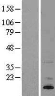 Western Blot: ASIP Overexpression Lysate [NBL1-07766]