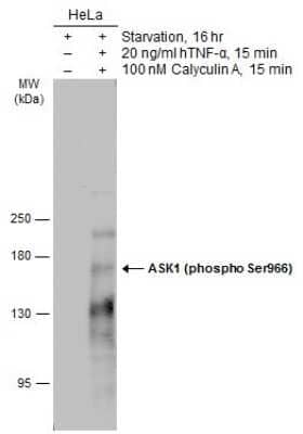 Western Blot: ASK1 [p Ser966] Antibody [NBP3-13306]