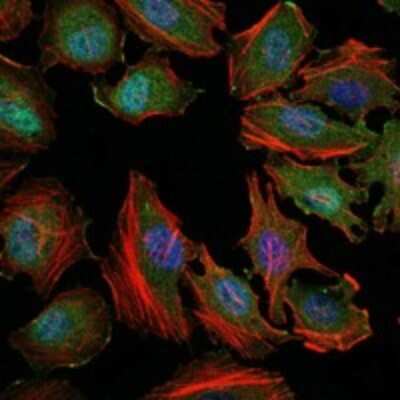 Immunohistochemistry: ASK1 Antibody (2E4) - BSA Free [NBP2-37592]