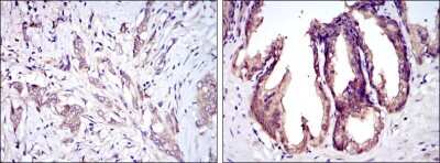 Immunohistochemistry: ASK1 Antibody (2E4) - BSA Free [NBP2-37592]