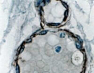 Immunohistochemistry-Paraffin: ASK1 Antibody [NB100-56077]