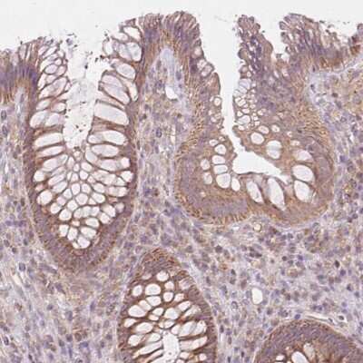 Immunohistochemistry-Paraffin: ASK1 Antibody [NBP2-56971]