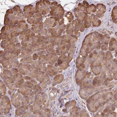 Immunohistochemistry-Paraffin: ASK1 Antibody [NBP2-57164]