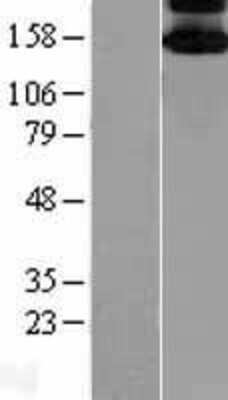 Western Blot: ASK1 Overexpression Lysate [NBL1-12856]