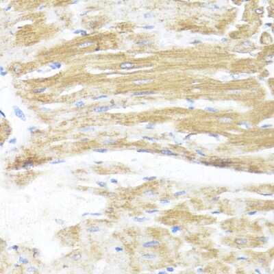 Immunohistochemistry-Paraffin: ASMT Antibody - BSA Free [NBP3-04634]