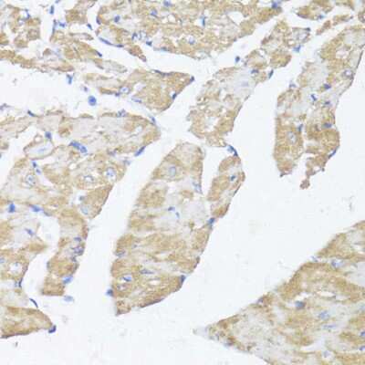 Immunohistochemistry-Paraffin: ASMT Antibody - BSA Free [NBP3-04634]