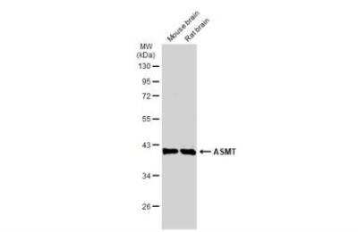 Western Blot: ASMT Antibody [NBP2-43801]