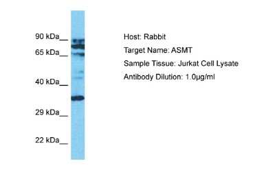 Western Blot: ASMT Antibody [NBP2-86583]