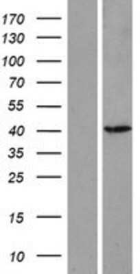 Western Blot: ASMT Overexpression Lysate [NBP2-07921]