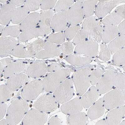 Immunohistochemistry-Paraffin: ASMTL Antibody [NBP1-86154]