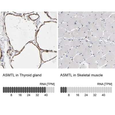 Immunohistochemistry-Paraffin: ASMTL Antibody [NBP1-86154]