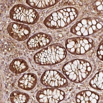 Immunohistochemistry-Paraffin: ASMTL Antibody [NBP1-86420]