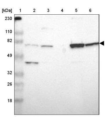 Western Blot: ASMTL Antibody [NBP1-86154]