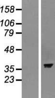 Western Blot: ASNA1 Overexpression Lysate [NBP2-07880]