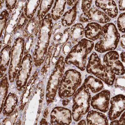 Immunohistochemistry: ASNSD1 Antibody [NBP2-38283]