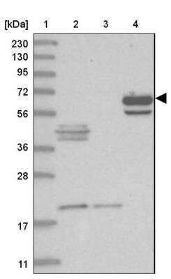 Western Blot: ASNSD1 Antibody [NBP1-83634]