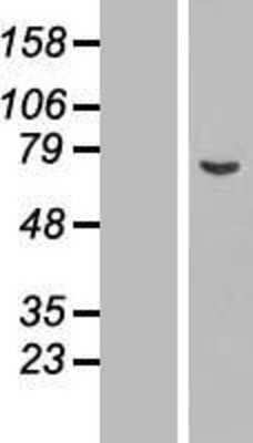 Western Blot: ASNSD1 Overexpression Lysate [NBL1-07771]