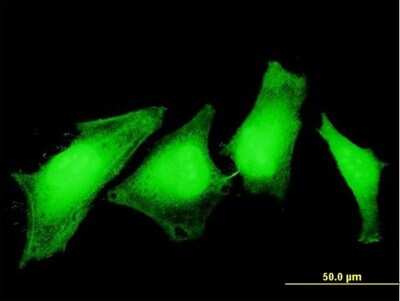 Immunocytochemistry/ Immunofluorescence: ASPA Antibody (3C11) [H00000443-M09]